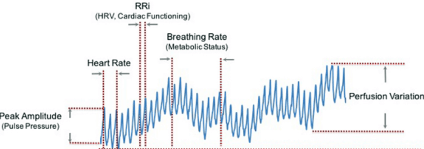 (Optical Sensor for Heart Rate Monitor) Waveform Analysis